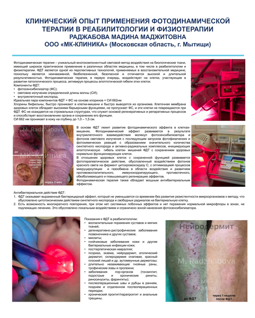 41. Клинический опыт применения фотодинамической терапии в реабилитологии и физиотерапии