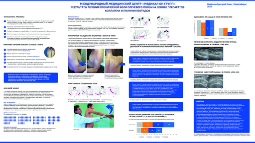 28. Результаты лечения хронической боли плечевого пояса на основе препаратов коллагена и полинуклеотидов