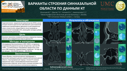 2. Варианты строения синназальной области по данным КТ