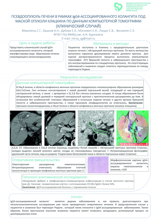 8. Псевдоопухоль печени в рамках IgG4-ассоциированного холангита под маской опухоли Клацкина по данным КТ (клинический случай)