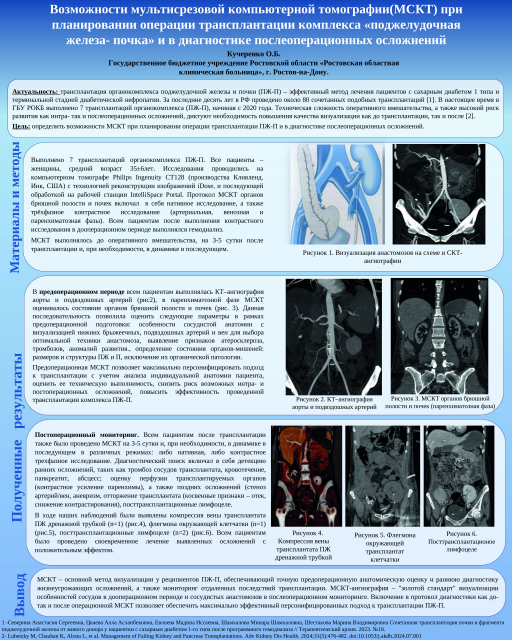 12. Возможности мультисрезовой компьютерной томографии(МСКТ) при планировании операции трансплантации комплекса «поджелудочная железа- почка» и в диагностике послеоперационных осложнений