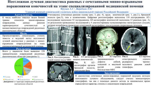 13. Неотложная лучевая диагностика раненых с сочетанными минно-взрывными поражениями конечностей на этапе специализированной медицинской помощи
