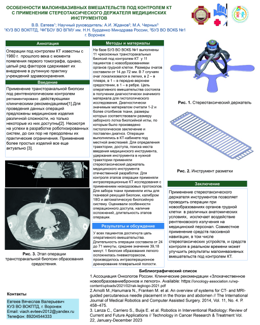 14. Особенности малоинвазивных вмешательств под контролем КТ с приминением стереотаксического держателя медицинских инструментов