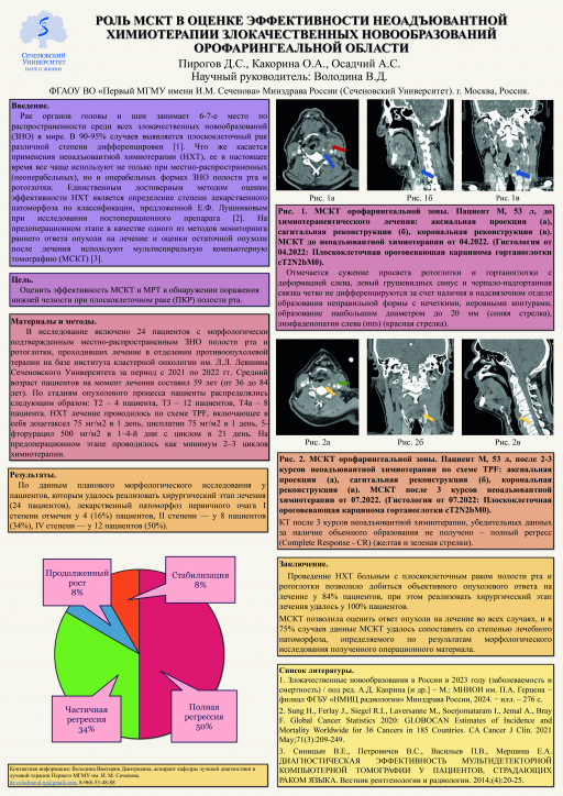 15. Роль МСКТ в оценке эффективности неоадъювантной  Химиотерапии злокачественных новообразований  орофарингеальной области