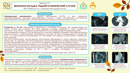 17. Венозная загадка: редкий клинический случай