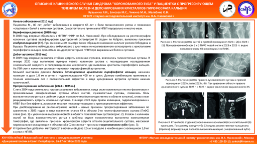 Описание клинического случая синдрома