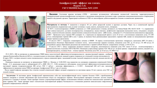 Анифролумаб: эффект на глазах
