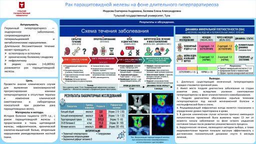 Рак паращитовидной железы на фоне длительного гиперпаратиреоза